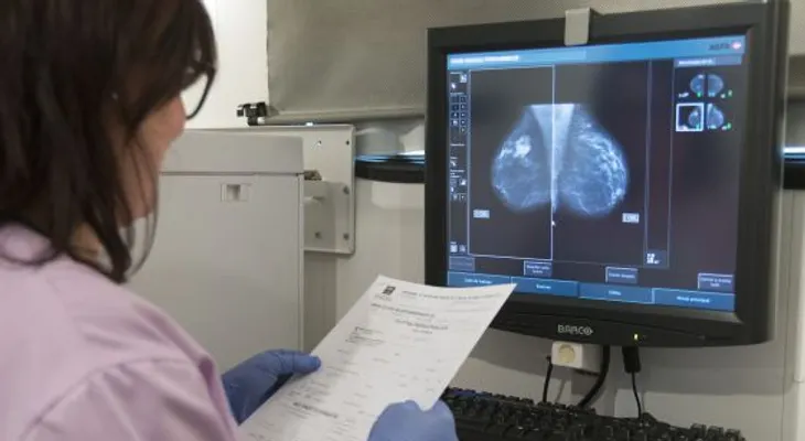  Las cuentas pendientes de la inmunoterapia con el cáncer de mama 