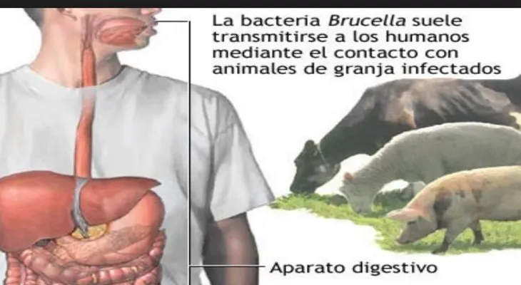 La brucelosis: Enfermedad bacteriana que se transmite al ser humano por animales 