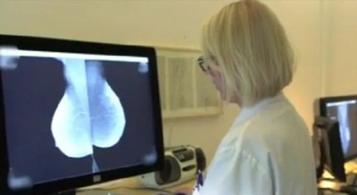 Conoce el nuevo método para detectar cáncer de mama