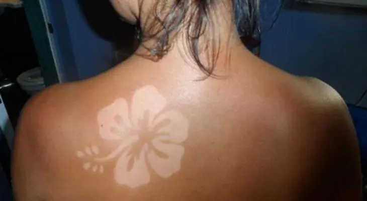 Los dermatólogos advierten del peligro de los tatuajes solares 