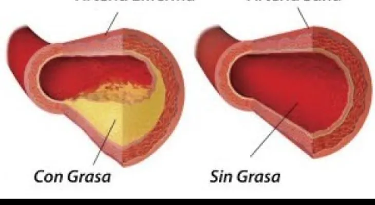 La quelación: Una técnica con excelentes resultados de desintoxicación del organismo. Beneficios de la terapia 