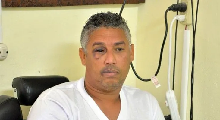 Recuperación de Danny Polanco es un proceso lento