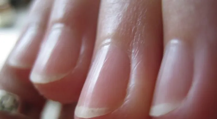 Comerse las uñas perjudica seriamente la salud 