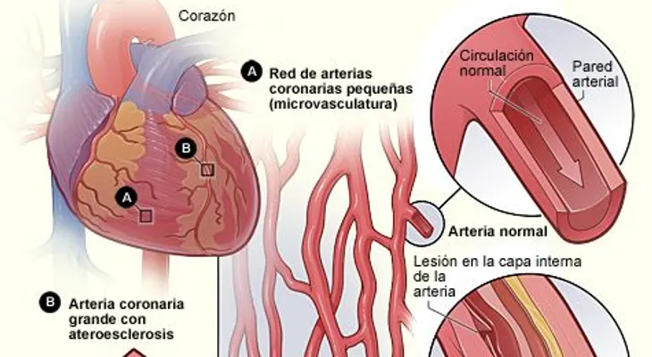 En R.Dominicana hay una epidemia de muertes por problemas coronario y de hipertensión