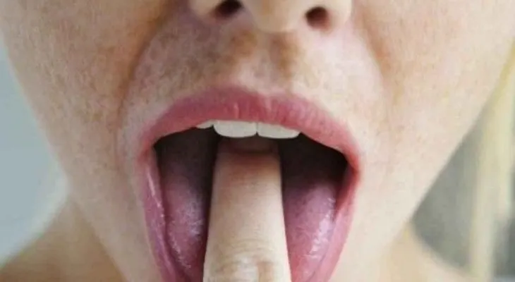 5 mitos comunes sobre la bulimia