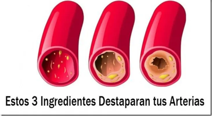 Limpia tus Arterias Coronarias con estos 3 ingredientes mágicos...