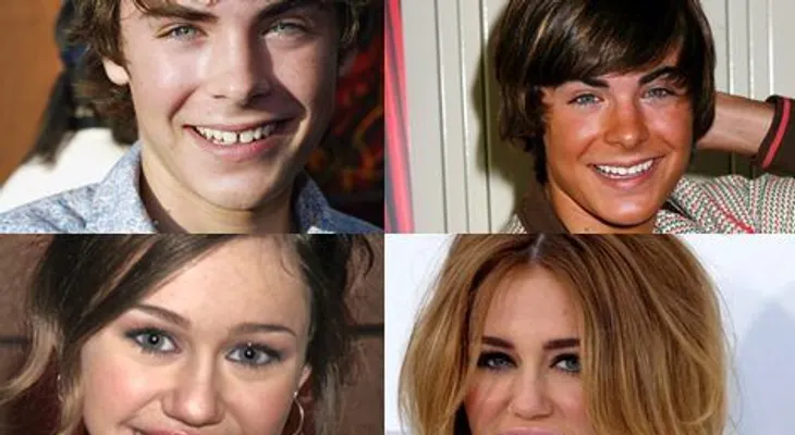 La claves para tener una sonrisa envidiable después de los 30 