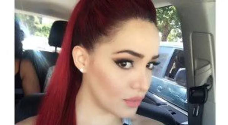 Karen Yapoort da tremendo boche a seguidora por decirle que se operó pómulos