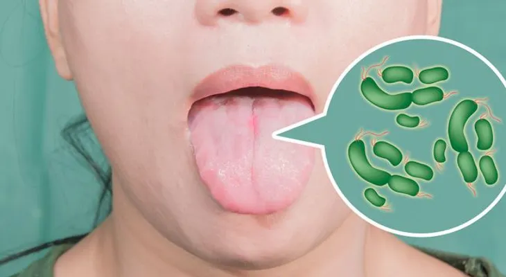 Las diferentes causas por la que nos duele la lengua. Entérate