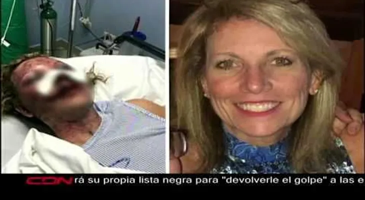PN se comunica con organismos internacionales para esclarecer ataque a turista 