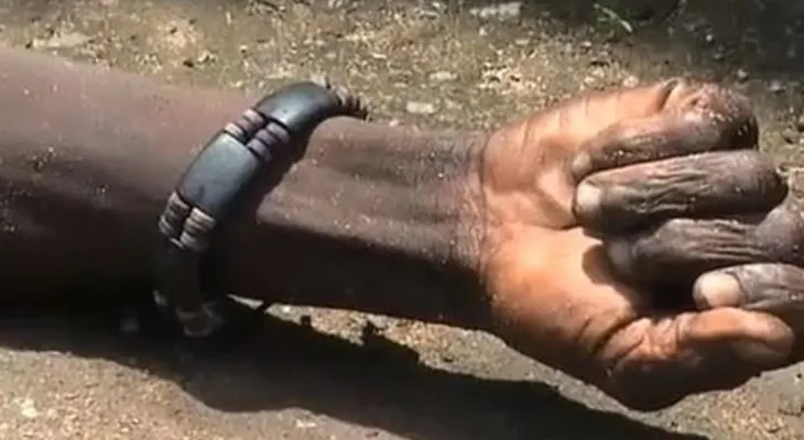 ¡Impactante!: enfermo con ébola "revive" (Video)