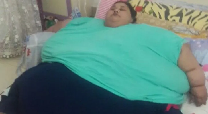 Muere la mujer más obesa del mundo por complicaciones de salud