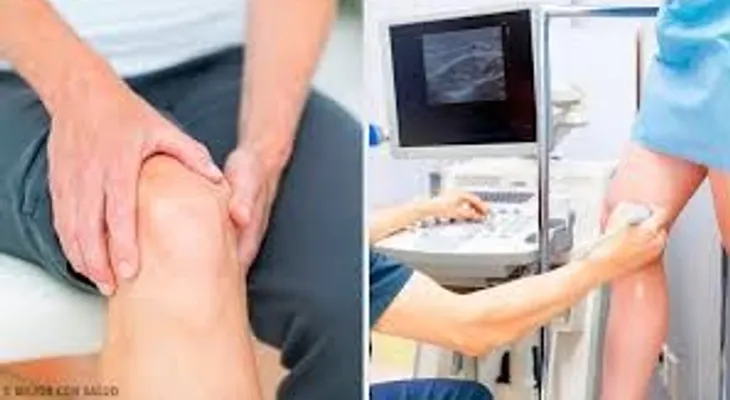 La tendinitis. Causas, síntomas y prevención