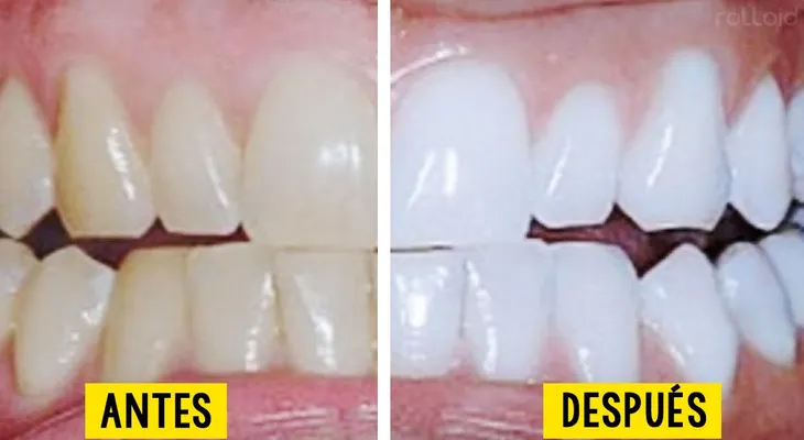 Mezcló estos tres ingredientes y los colocó en sus dientes? No podrás creer los resultados