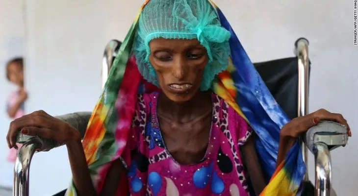 20 millones de personas podrían morir de hambre en los próximos meses, dice la FAO
