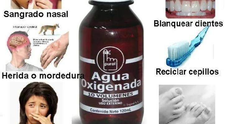10 remedios con agua oxigenada