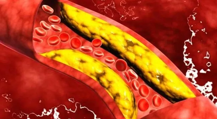 Destapa tus arterias y regula tu presión baja con solo 4 cucharadas de esta bebida. Es imperdible
