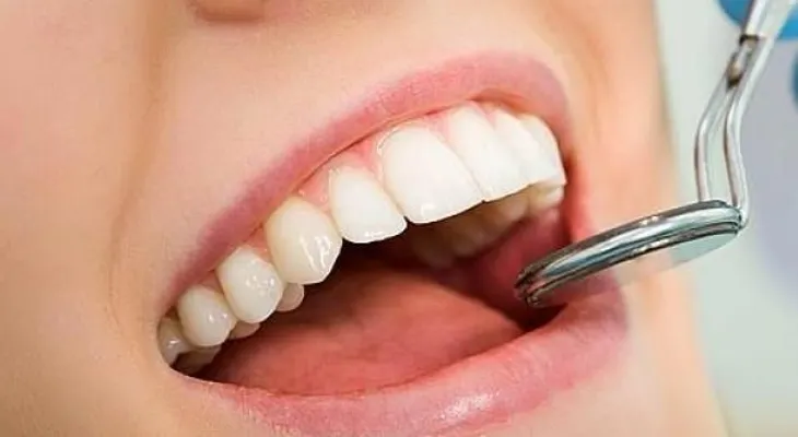 ¿Quistes bucales? Conoce esta patología silente y muy común 