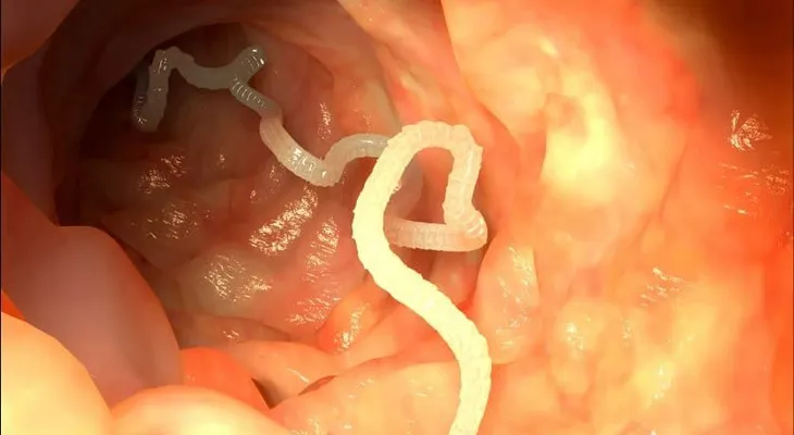 Remedios que no FALLAN para decirle adiós a estos terribles parásitos que puedes tener en tu cuerpo 