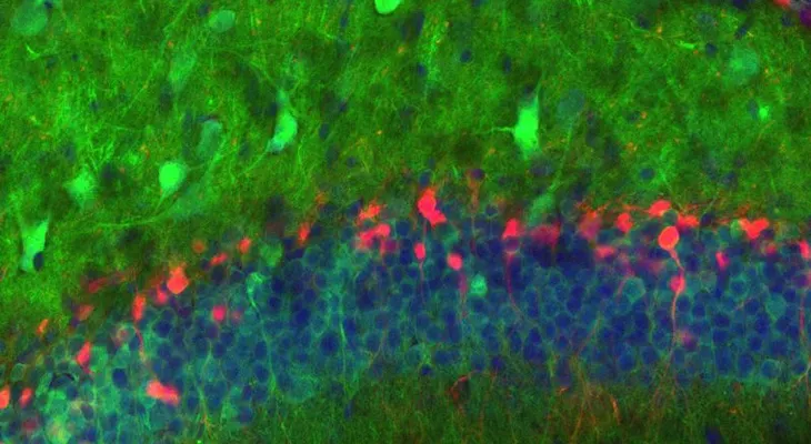 Revolucionario estudio logró observar por primera vez el nacimiento de nuevas neuronas