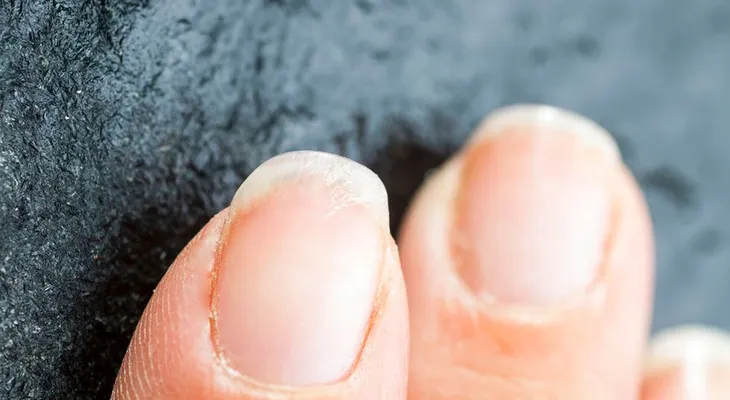 ¿Sufres de uñas débiles? 5 remedios naturales para combatirlas