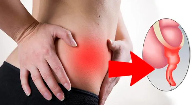 Si siente un dolor abdominal inferior derecho es una apendicitis