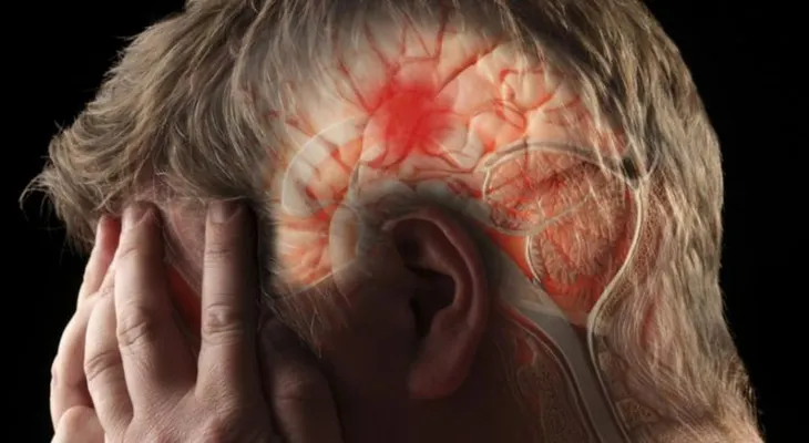 Sociedad Dominicana de Neurología urge ampliar respuesta estatal ante accidentes cerebrovasculares