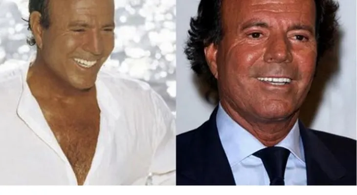Algunos personajes famosos con pelo implantado y otros que usan peluca