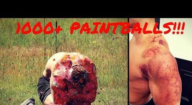 IMAGENES PUEDEN RESULTAR FUERTES: Así queda el cuerpo tras recibir 1.000 disparos de paintball