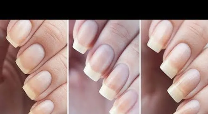 Así se usa el bicarbonato de sodio para tener las uñas más largas y fuertes 