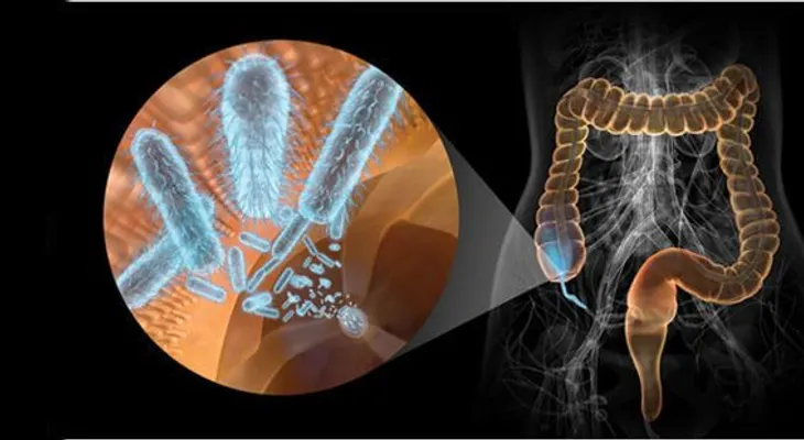  Microbios intestinales pueden influir en desarrollo de esclerosis múltiple 