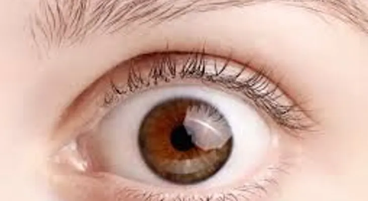 Los científicos traen mala noticia para las personas que tienen ojos marrones