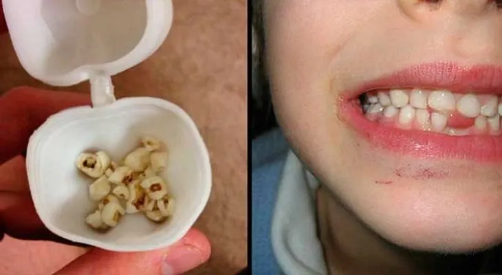 ¡No botes los dientes de leche de tus hijos! Esos pequeños recuerdos son una mina de oro para tu salud?