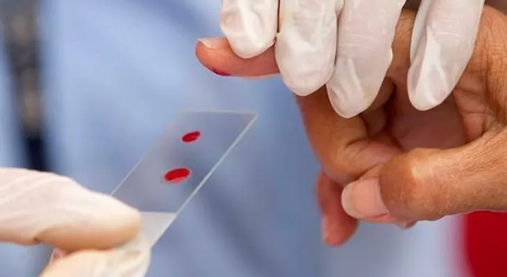La hemofilia, el miedo a vivir siempre con el peligro de las hemorragias