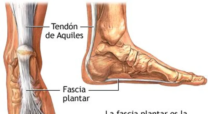Si siente un dolor intenso en los pies puede ser la ruptura del tendón de Aquiles