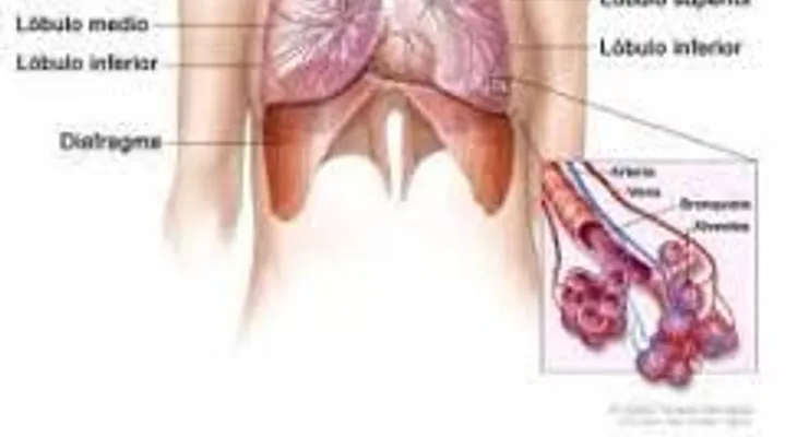 Efectivos remedios para la bronquitis, la tos, el asma y las enfermedades pulmonares