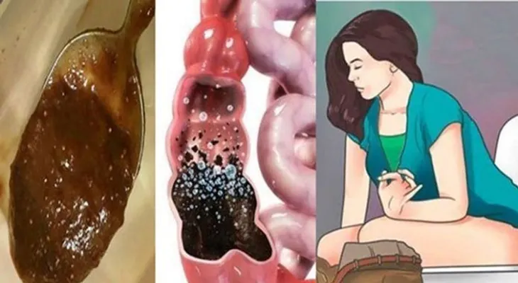 Una sola cucharada y saldrá corriendo al baño para eliminar todos los desechos del intestino.