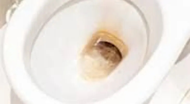 Papel de aluminio y vinagre, el increíble truco para evitar manchas en el inodoro