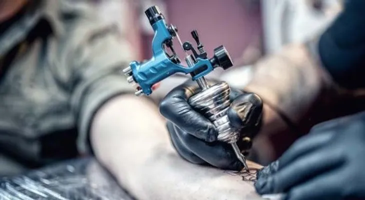 ¿Se puede eliminar un tatuaje?