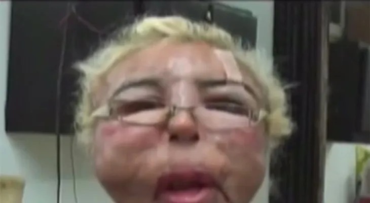 Video: para lucir un rostro joven.