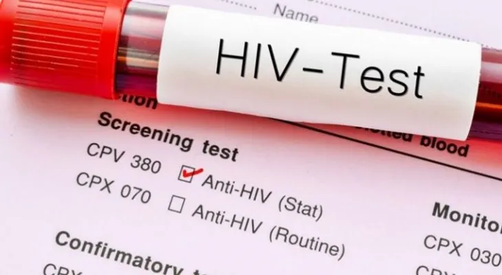 Prueban en humanos un nuevo tipo de vacuna contra el sida