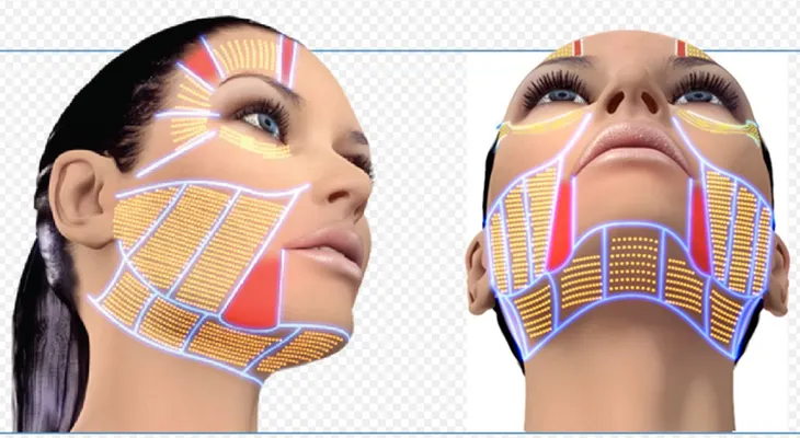 Con Ultherapy dile adiós a las arrugas