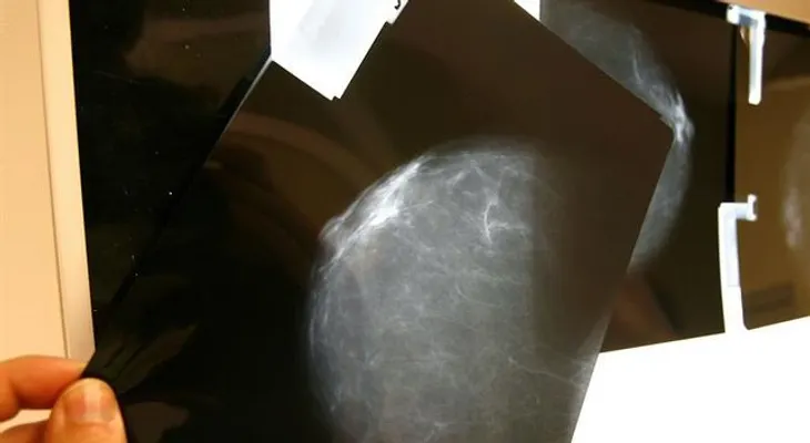  Crean herramienta que podría usarse para identificar el cáncer 