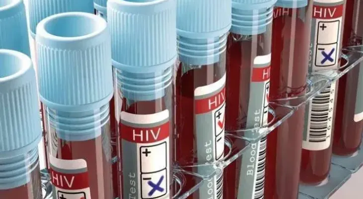Una vacuna experimental contra el VIH resulta prometedora en animales