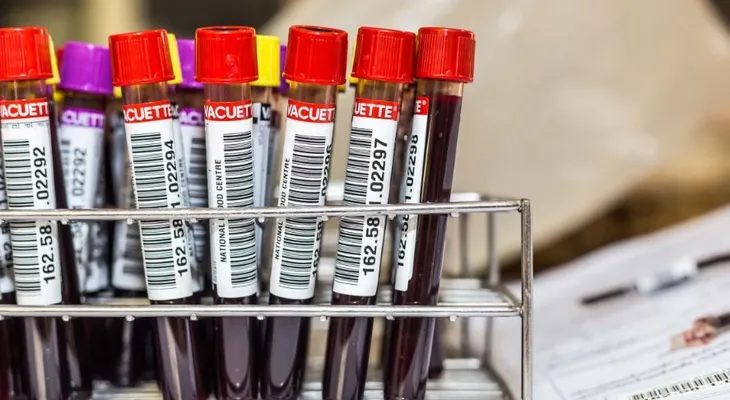  Cáncer de próstata, pulmón y ovario ya se puede detectar con muestras de sangre y orina en RD 