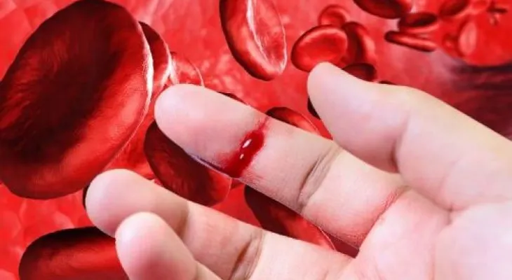 La situación de pacientes con hemofilia ha llegado a nivel crítico