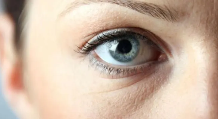 Conoce las posibles causas y soluciones para las ojeras