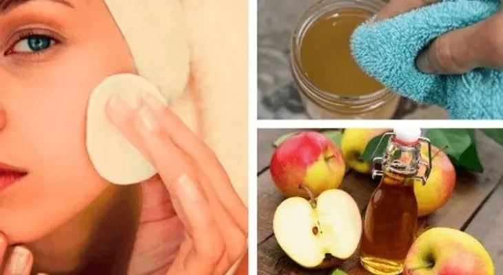 Cómo actúa el vinagre de manzana en la piel?