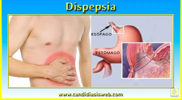 La dispepsia, tratamientos eficaz