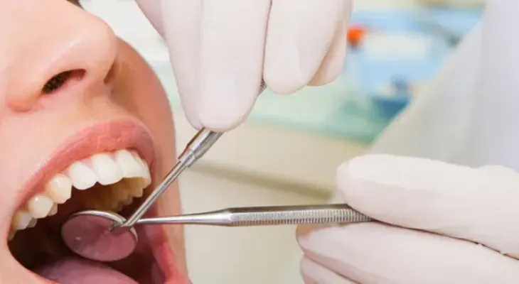 Mala higiene oral provoca periodontitis